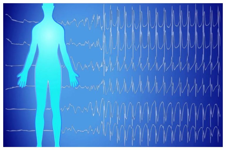 How Does PEMF Affect the Body