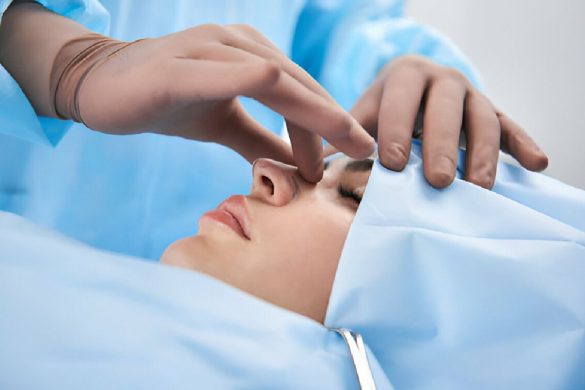 Rhinoplasty Surgery