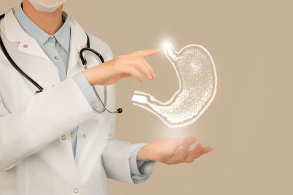gastric sleeve surgery